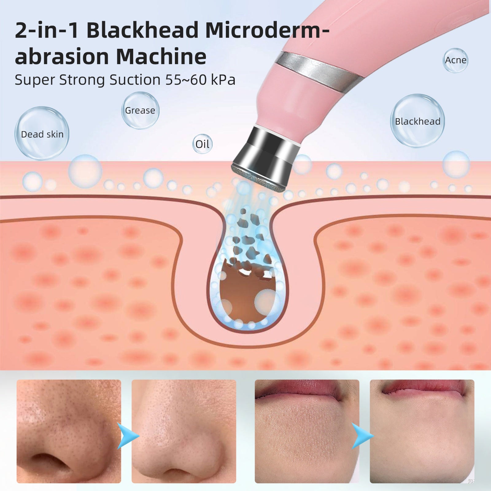 Portable Diamond Microdermabrasion Machine Facial Peeling Device Exfoliation Vacuum Blackhead Remover With 4 Diamond Peeling Tip